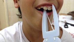 Dentista de Cuiab&aacute; cria aparelho fixador e passador de fio dental para pacientes com defici&ecirc;ncia